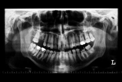 Radiologie Dentaire CIN Paris Daumesnil