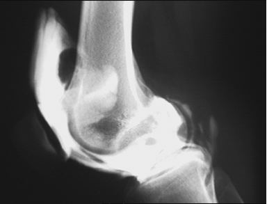 Radiologie Arthrographies CIN Paris Daumesnil