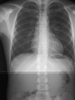 Radiologie Thoracique CIN Paris Daumesnil