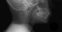 Radiologie Numérisée CIN Paris Daumesnil