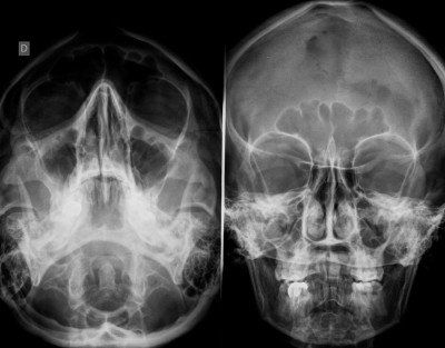 Radiologie Sinus CIN Paris Daumesnil