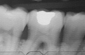 Radiologie Dentaire CIN Paris Daumesnil