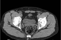 Scanner UrinaireCIN Paris Daumesnil