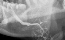 Radiologie Dentaire CIN Paris Daumesnil