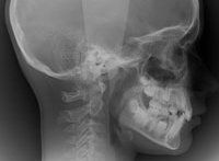 Radiologie Dentaire CIN Paris Daumesnil
