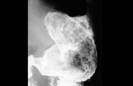 Radiologie TOGD CIN Paris Daumesnil