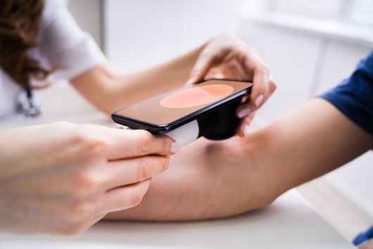 Doctor Examining Pigmented Skin