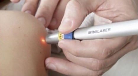 trattamento cutaneo con laser