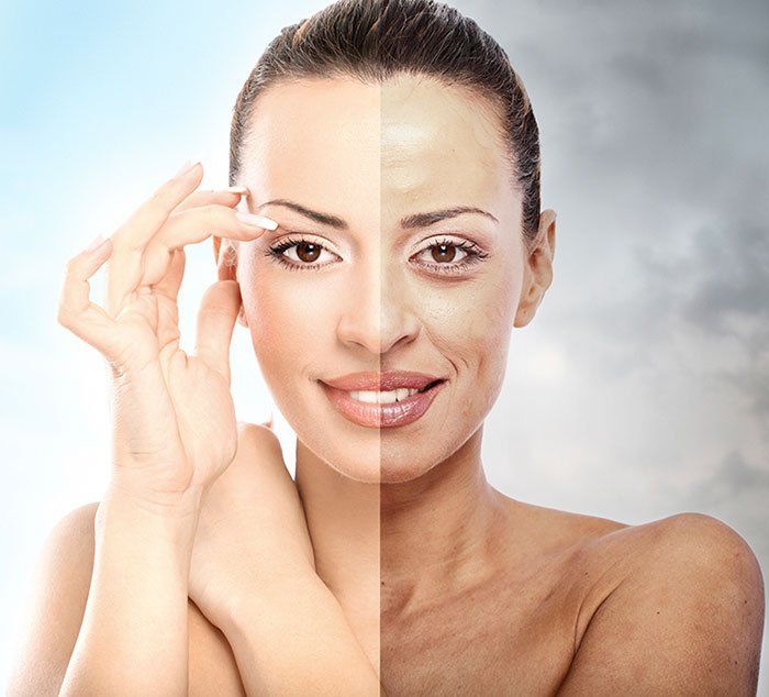 Dry Skin