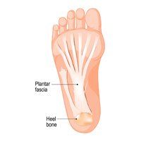 Plantar Fasciitis — Newport, RI — Newport Family Foot Care