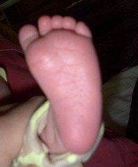 Baby's Foot — Newport, RI — Newport Family Foot Care Baby's Foot — Newport, RI — Newport Family Foot Care