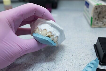 Dental Bridges — Dentistry in Newport News, VA Dental Bridges — Dentistry in Newport News, VA