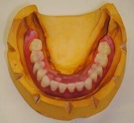 Denture Base And Tooth Arrangement — Newport News, VA - Tidewater Prostho