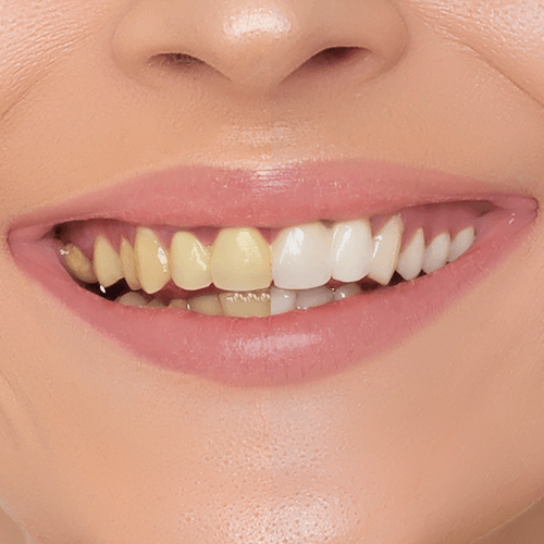 A close up of a woman 's mouth with white teeth and pink lips.