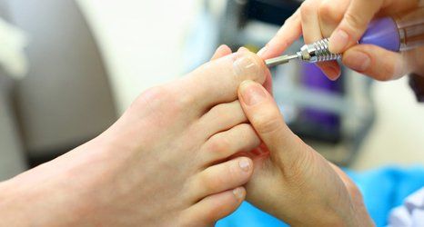 Callus and corn removal