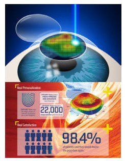 LASIK surgery bangalore