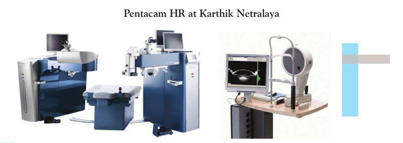 LASIK surgery bangalore