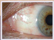 best retina surgeon bangalore