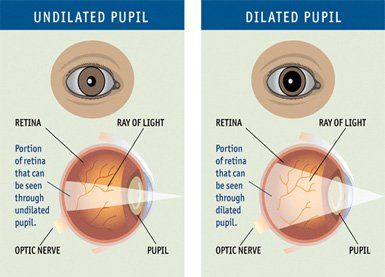 retina examination bangalore
