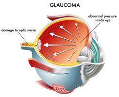 best retina doctor bangalore