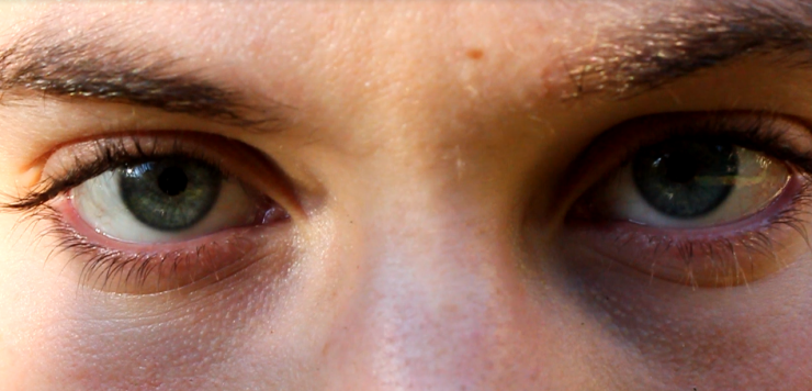 A close up of a woman 's eyes with black circles under them.