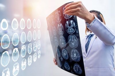 Doctor Holding MRI Film — Portsmouth, VA — Michael Jerome Massie PC. Doctor Holding MRI Film — Portsmouth, VA — Michael Jerome Massie PC.