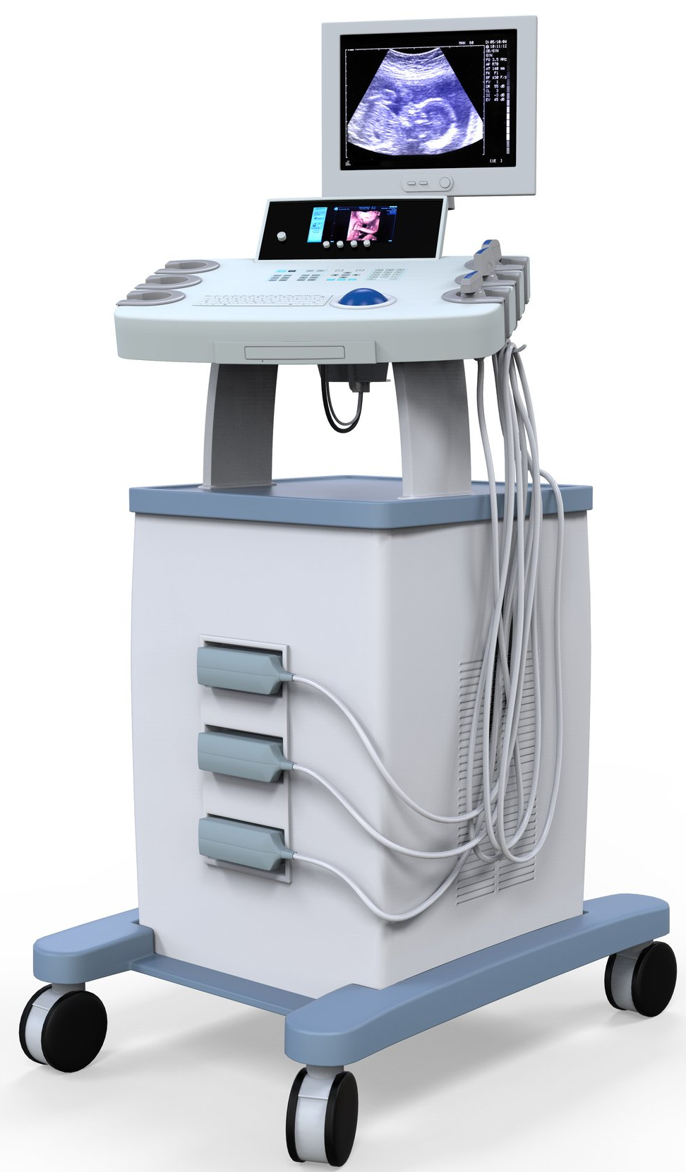 Medical Ultrasound Diagnostic Machine — Minneapolis, MN — Bester Bros Transfer & Storage Co Medical Ultrasound Diagnostic Machine — Minneapolis, MN — Bester Bros Transfer & Storage Co