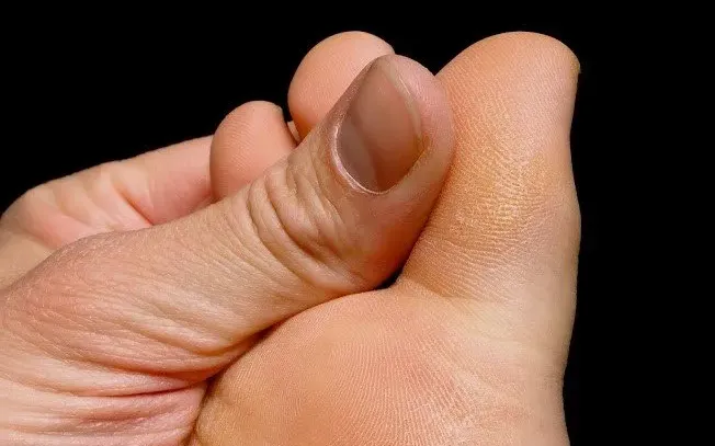 foot callus and corn foot callus and corn