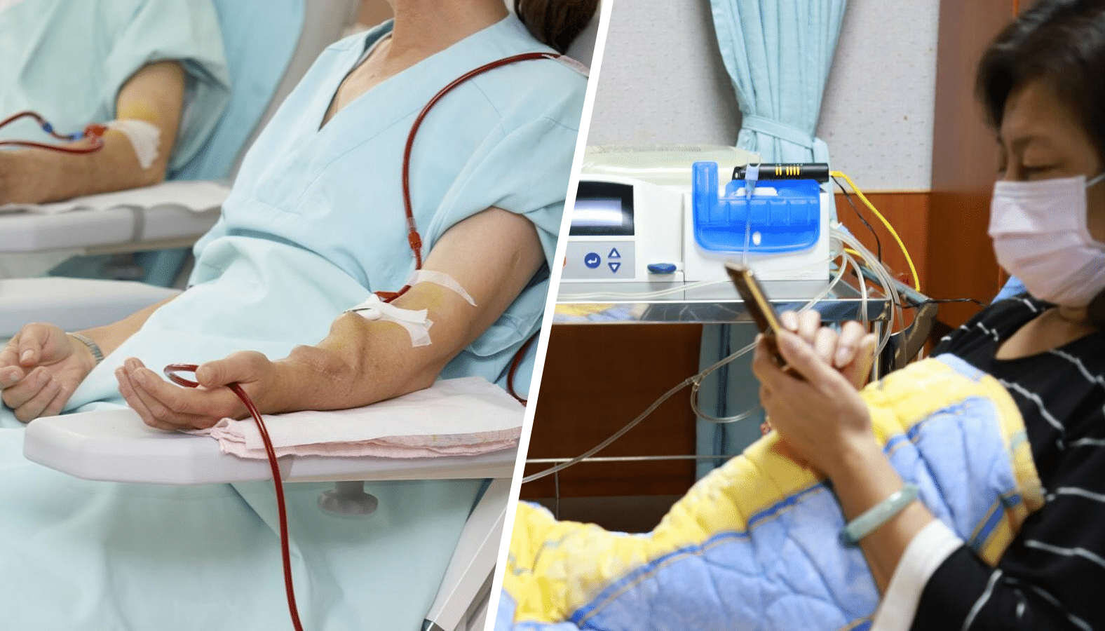 peritoneal-dialysis-haemodialysis-differences