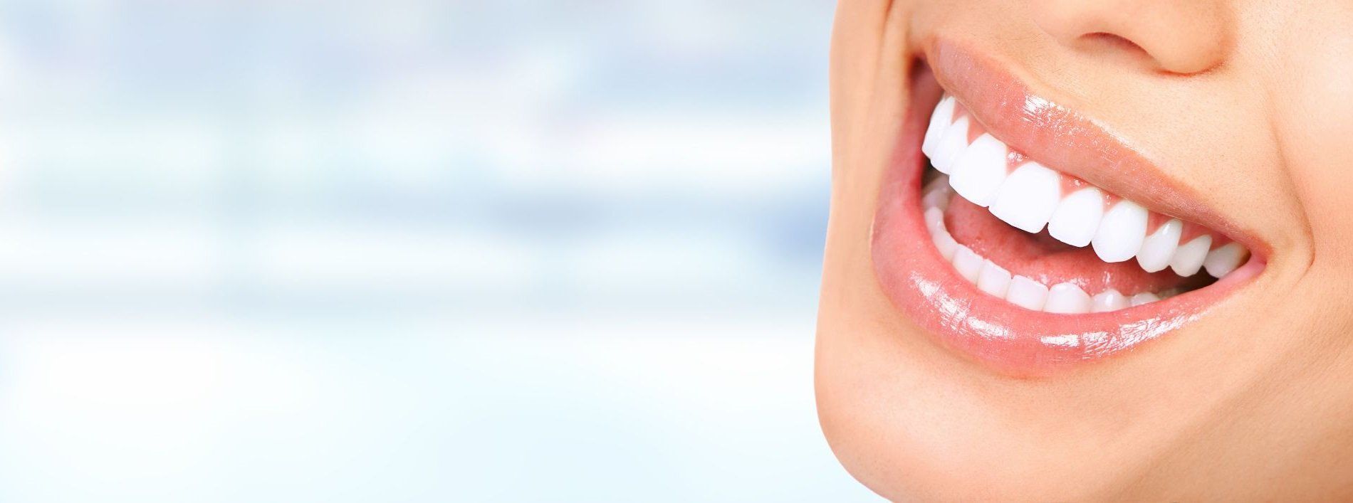 Denti sani e lucenti dopo un trattamento di sbiancamento dentale