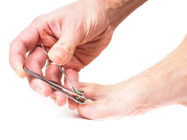 Ingrown Toenail Removal Tullahoma TN Ingrown Toenail Removal
