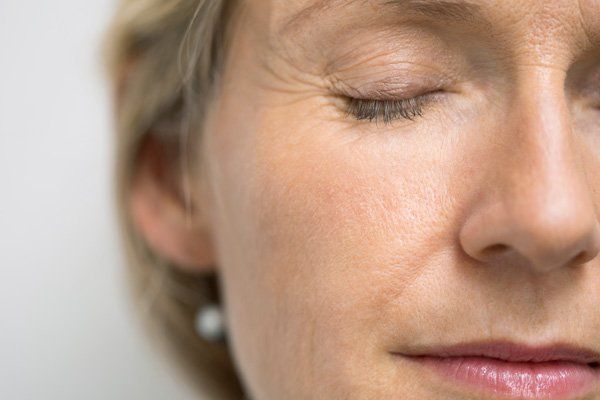 woman with eye wrinkles
