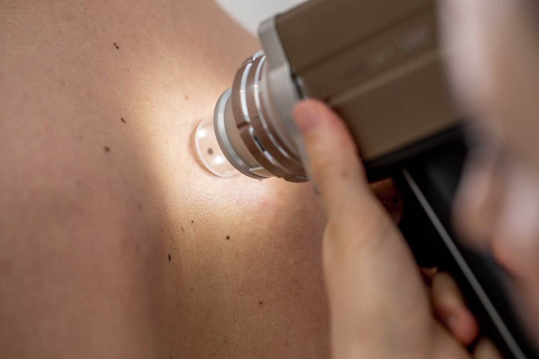diagnostica e trattamenti della pelle