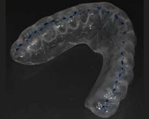 Bite