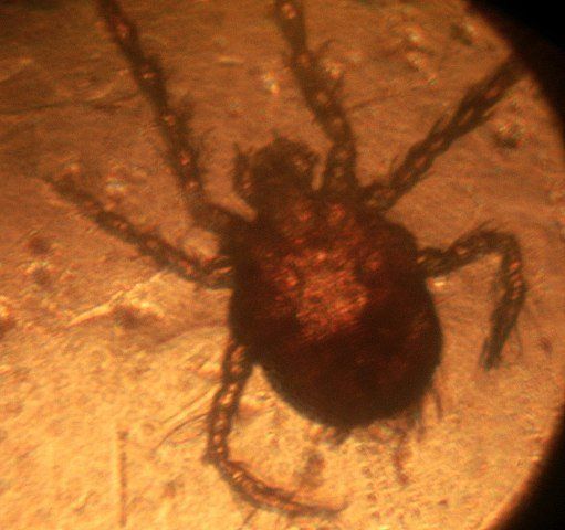 Harvest Mite