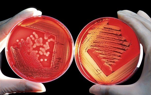 Bacteria growing on agar plate Bacteria growing on blood agar