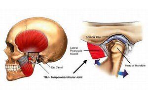 TMJ/TMD treatment