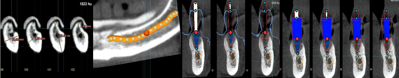 Visualizzazioni radiali con Arco SynSurgery