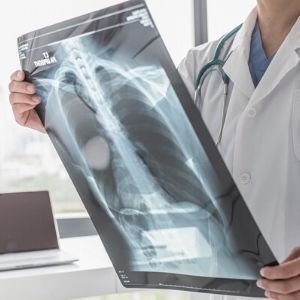 A medical professional in a white coat holds up a chest X-ray in a clinical setting.