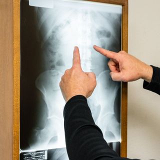 Checking Back Of Patient — Sunnyside, WA — Yakima Valley Chiropractic Center Checking Back Of Patient — Sunnyside, WA — Yakima Valley Chiropractic Center