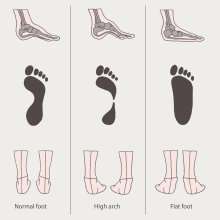 Orthotics Print — Sunnyside, WA — Yakima Valley Chiropractic Center