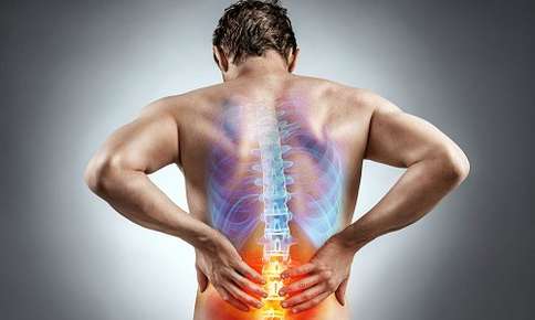 Backpain Remedy — Sunnyside, WA — Yakima Valley Chiropractic Center