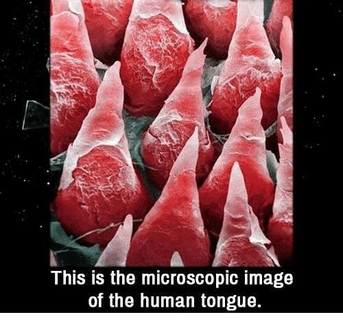 Microscopic view of human tongue, with red, cone-shaped papillae.