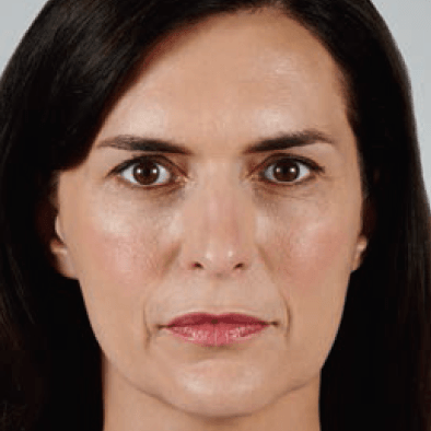 Woman with deep wrinkles around eyes and mouth, brown hair, looking forward.