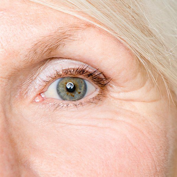 Wrinkles โ Metairie, LA โ Dr. Carter D. Paddock