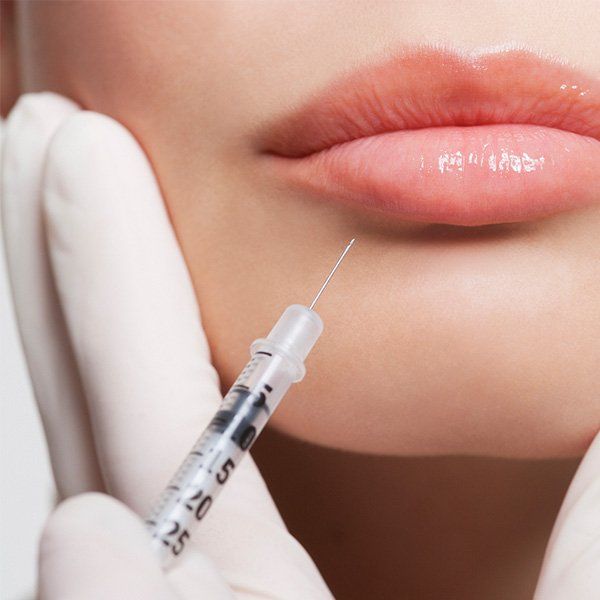 Lip Enhancement — Metairie, LA — Dr. Carter D. Paddock Lip Enhancement — Metairie, LA — Dr. Carter D. Paddock