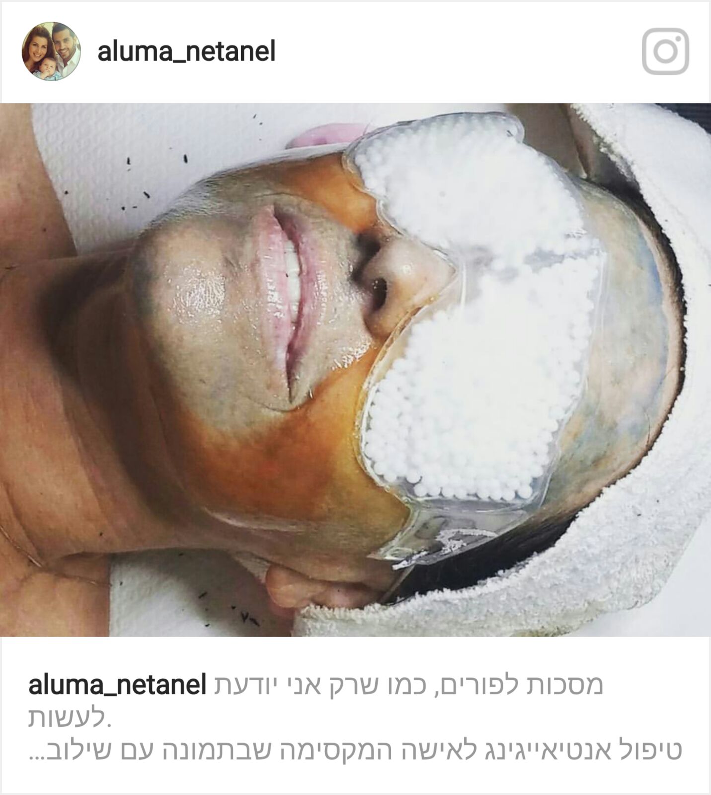 Woman lying down with a facial mask and white pads covering her eyes and forehead