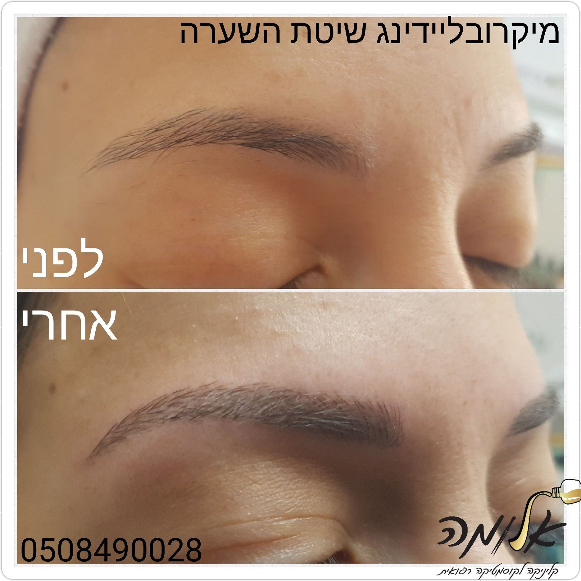 לפני ואחרי מיקרובליידינג לגבות: גבות דקות מול גבות מלאות ומוגדרות יותר.