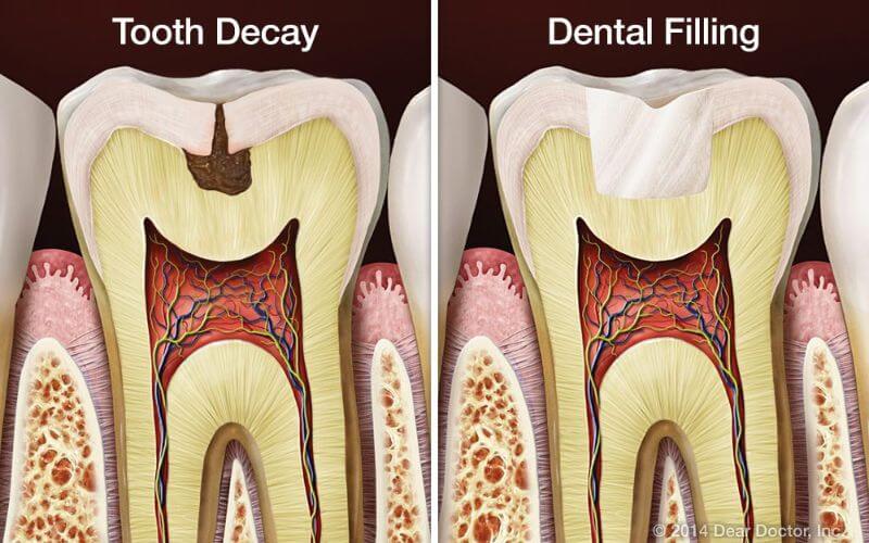 Zobu terapija un endodontija