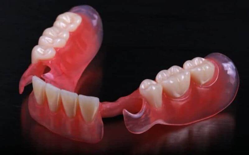 Все виды съемного протезирования, включая Valplast и Flexite